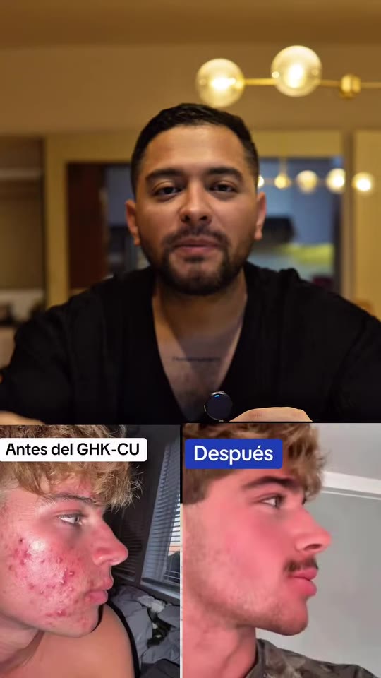 @felix.garaayy's GHK-Cu claims about skin, fact-checked