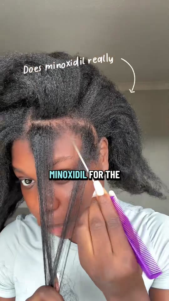 Minoxidil and peptides for hair loss: what the evidence actually shows