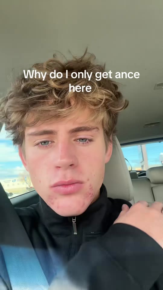 Can peptides like GHK-Cu actually clear chin acne?