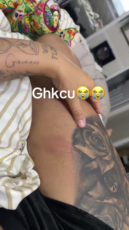 GHK-Cu peptide claims on TikTok: what the science says