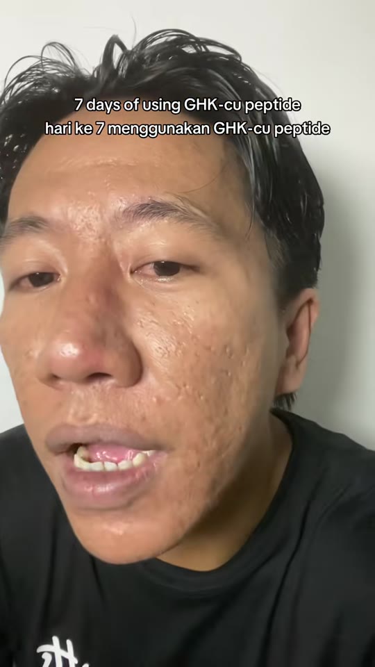 @fluxaxe's 7-day GHK-Cu peptide claims, fact-checked