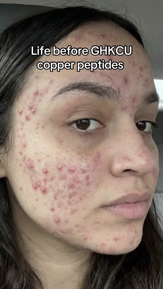 @natalia.yuri3's copper peptide claims, fact-checked