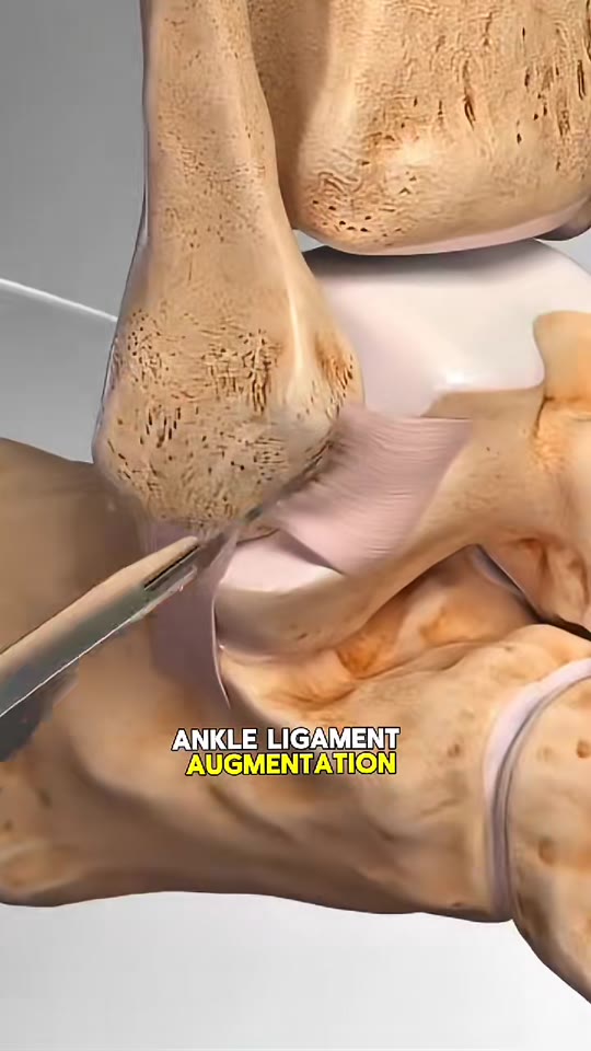 Ankle ligament repair and peptides: separating surgery facts from hype