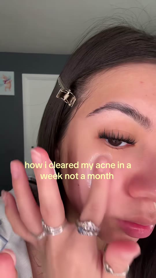 GHK-Cu for acne: what TikTok skips over in the science