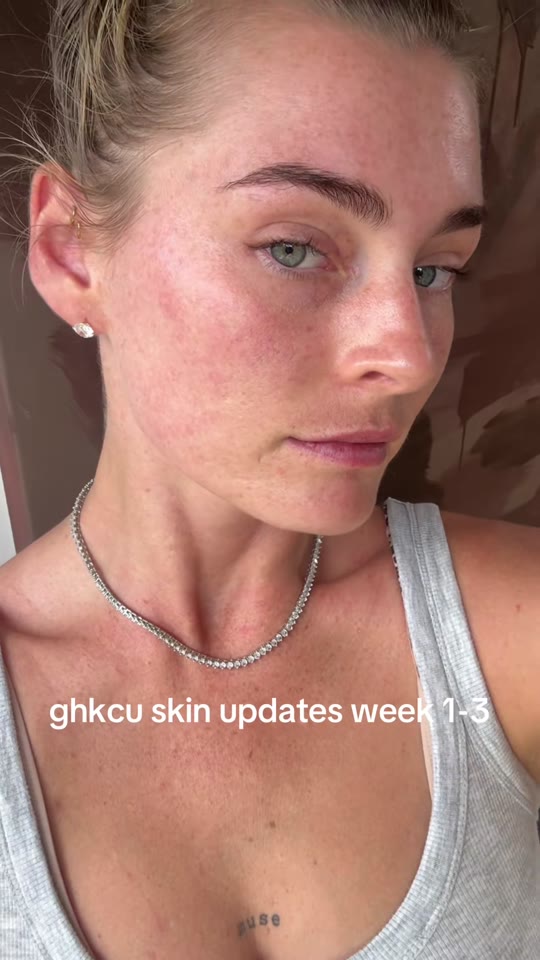 @an_average.jo's GHK-Cu skin claims need more time to judge