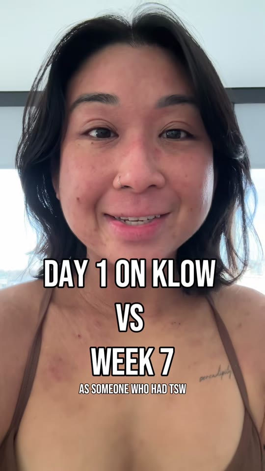 GHK-Cu and KPV peptides for skin recovery: what the evidence shows