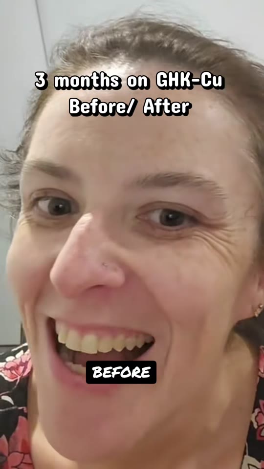 GHK-Cu peptide skin claims: what the evidence actually shows