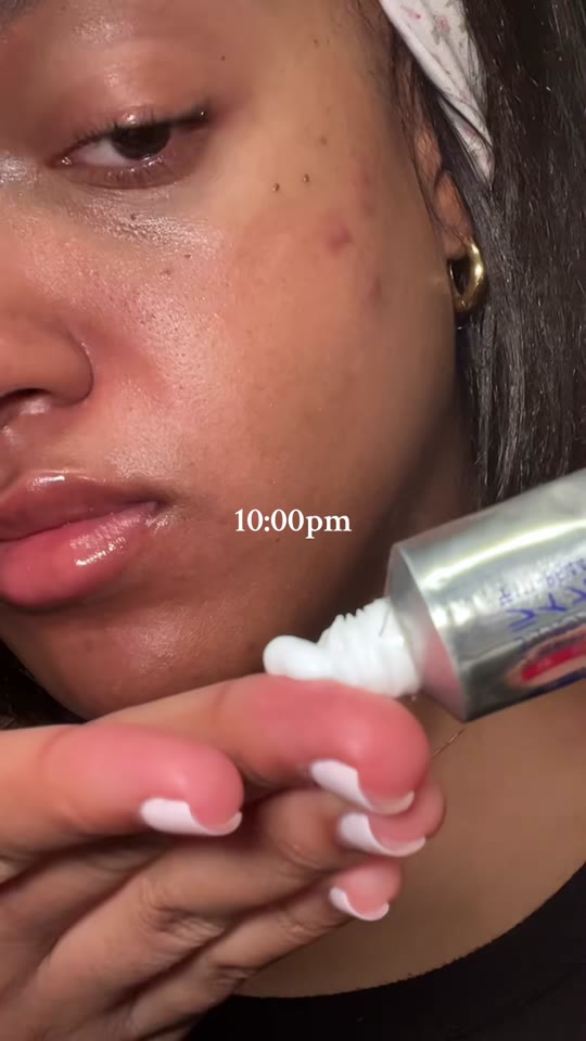 Sleeping position and acne breakouts: what the skin science shows