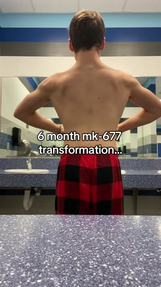 MK-677 for muscle gains: what the hype leaves out