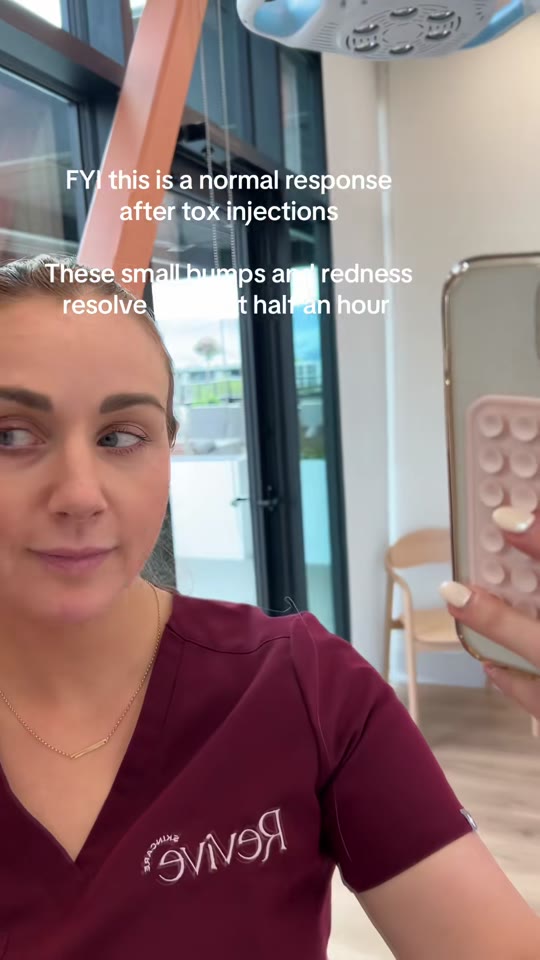 Post-injection bumps after botox: fluid response or filler mix-up?