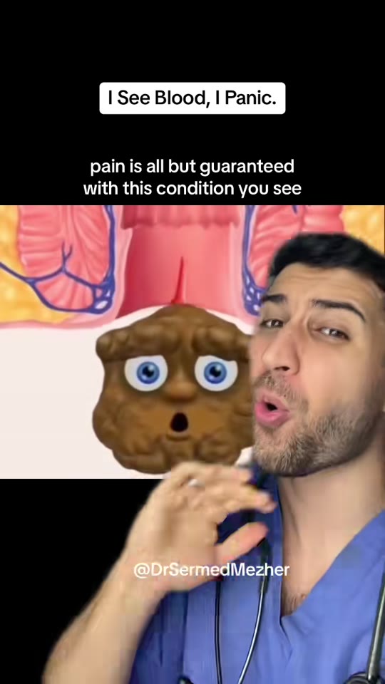 Anal fissures and fiber: what TikTok skips over