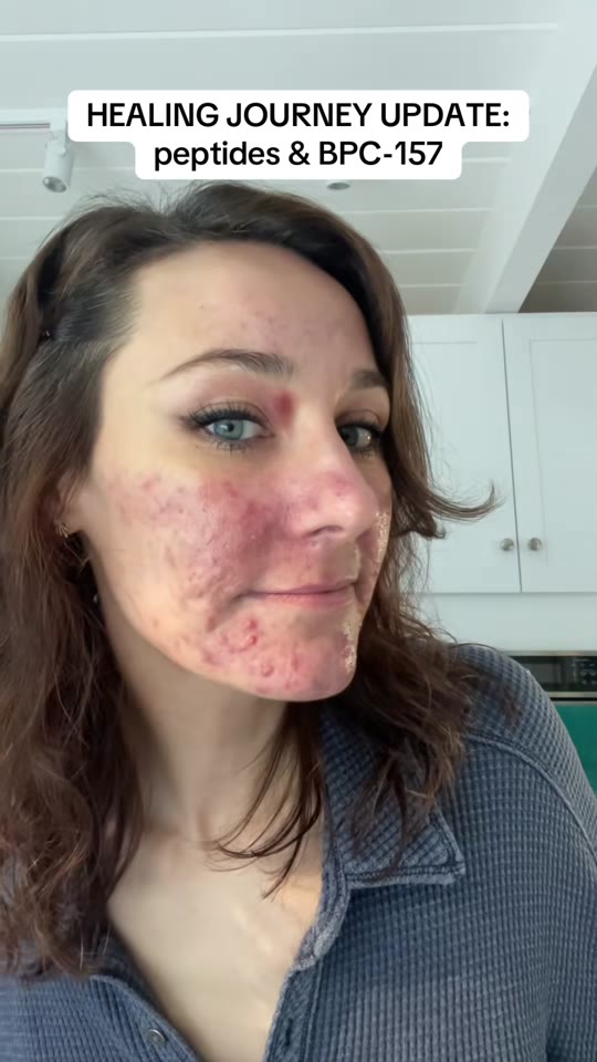 This TikTok's BPC-157 healing claims need serious scrutiny