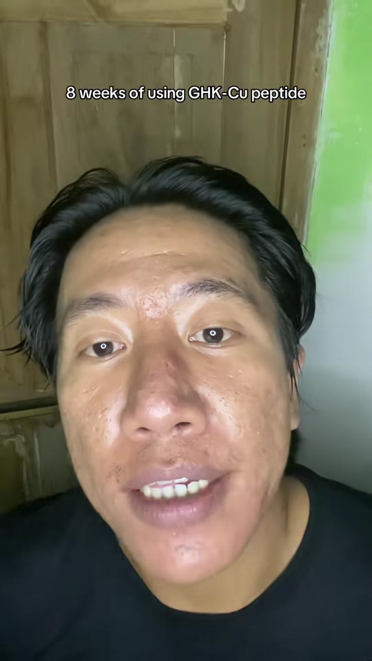 @fluxaxe's GHK-Cu peptide claims need some context