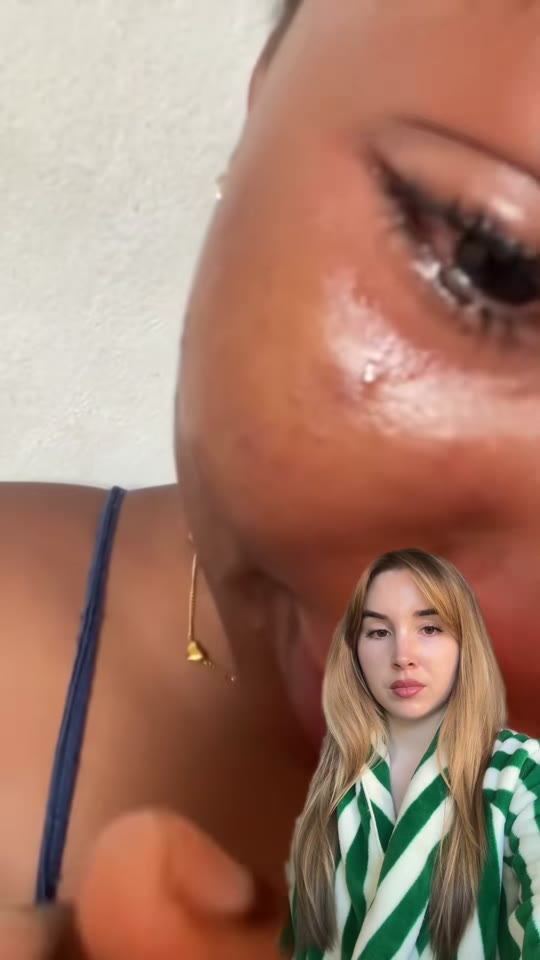Does acne come down to luck, hormones, or something else entirely?