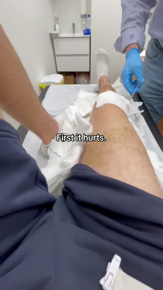 BPC-157 and TB-500 for knee surgery recovery: hype vs. evidence