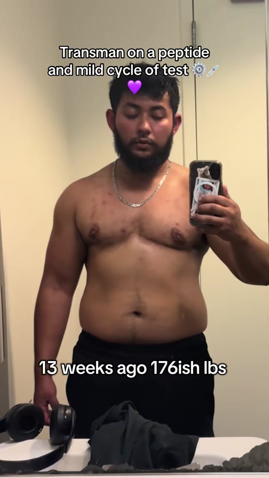 Peptides and FTM transition: separating hype from evidence