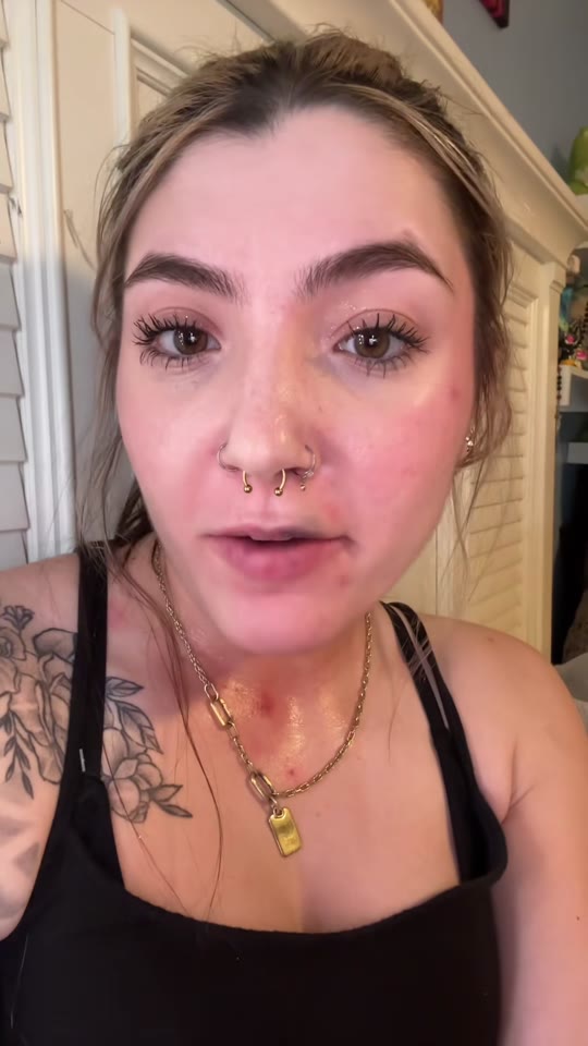 GHK-Cu lip injections: what the 'bruised lips' trend gets wrong