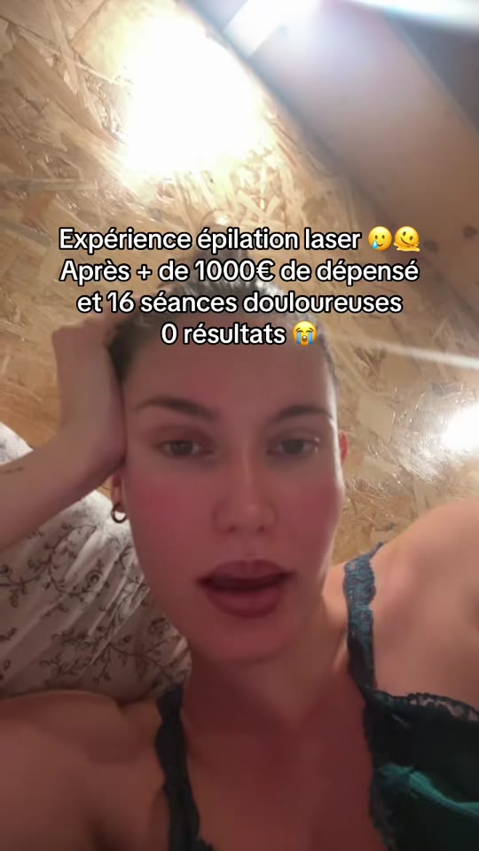 Laser hair removal complications: what TikTok gets wrong