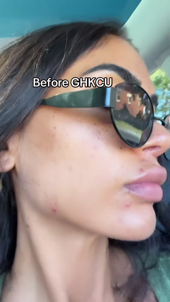 @natashawakefield1's GHK-Cu skin claims, fact-checked