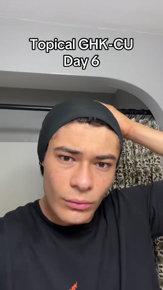 GHK-Cu and skin hydration: what TikTok gets wrong