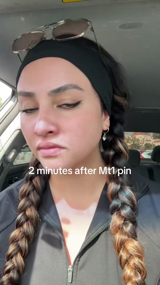 @qniquephysic's MT1 tanning peptide claims, fact-checked