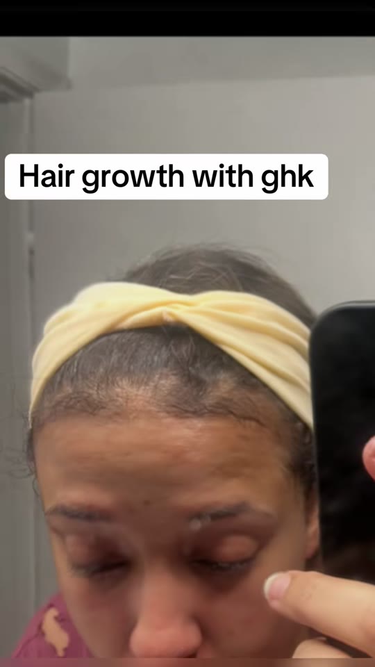 @kkelly1865's GHK-Cu hair growth claims, fact-checked