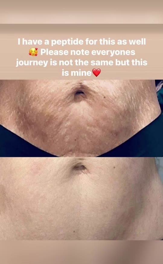 TikTok's peptide promises: what the studies actually show