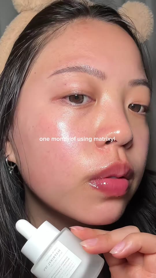 Matrixyl 10% for skin: what the peptide science actually supports