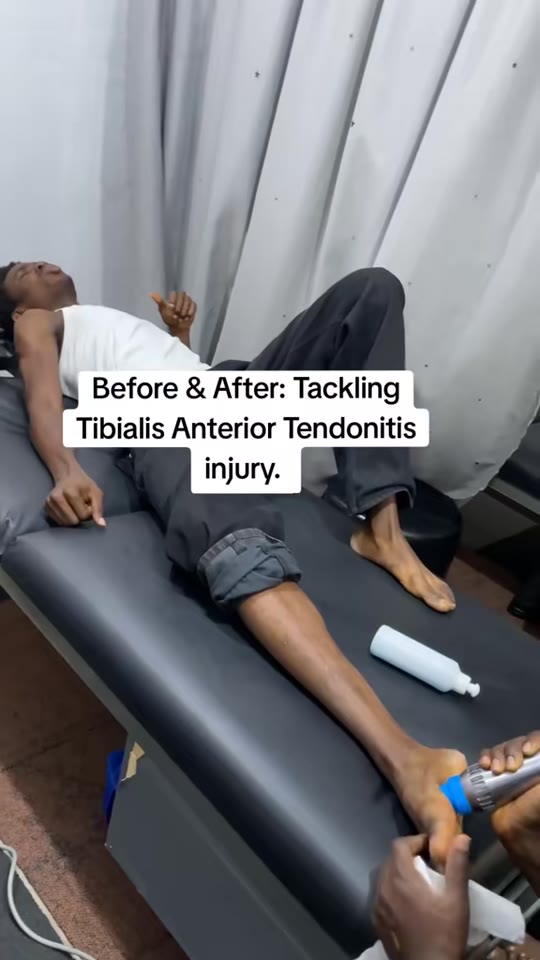 Tibialis anterior tendonitis: do these three therapies actually work?