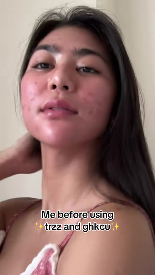 @mariahnicolevaldez's peptide biohacking claims need context