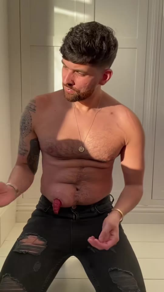 Ostomy bags and Crohn's disease: what the TikTok gets right and wrong