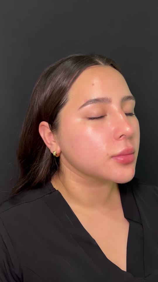 GHK-Cu skin injections: what the collagen science actually shows