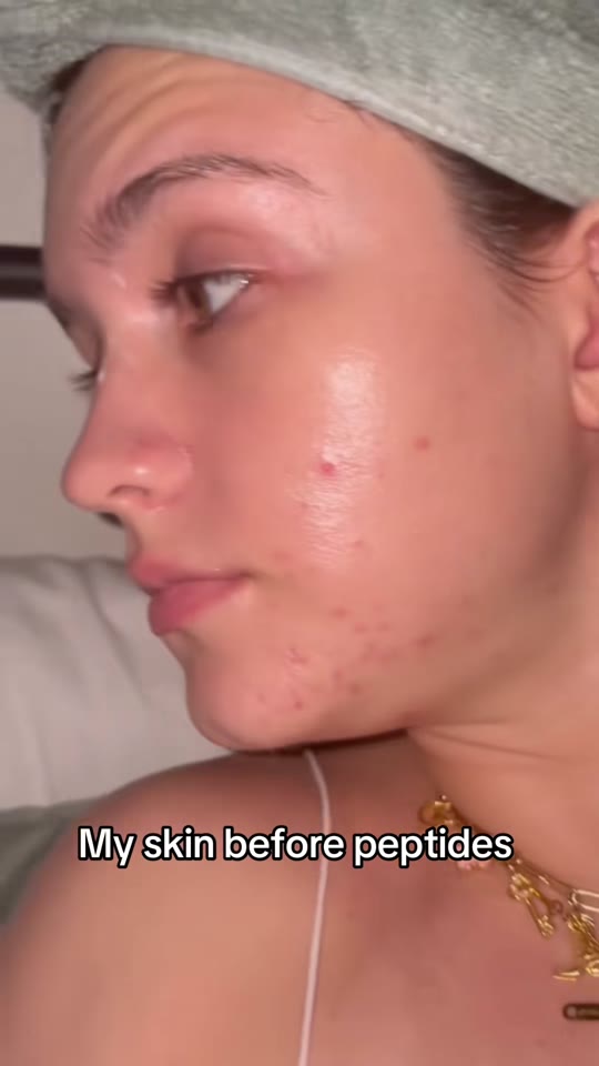 @flarfcakee's peptide therapy claims, fact-checked