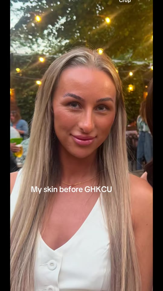 GHK-Cu peptide for skin: what the research actually shows