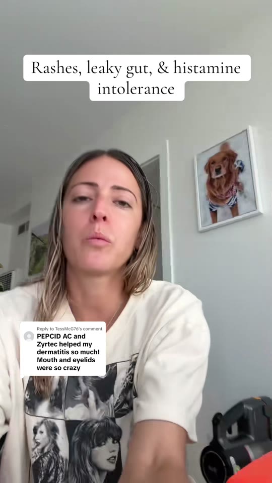 Peptides for histamine intolerance: hype check on a trending TikTok claim