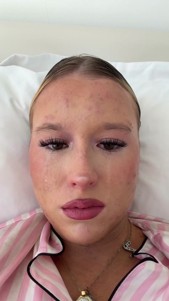 Can peptides like GHK-Cu actually clear acne? Here's what the research shows