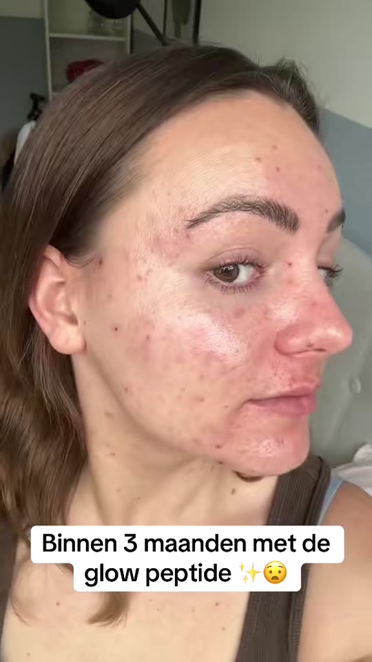 @peptidessnl's Glow70 peptide claims need a reality check