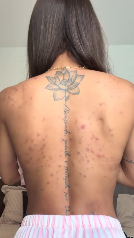 GHK-Cu for hormonal acne: what the evidence actually shows
