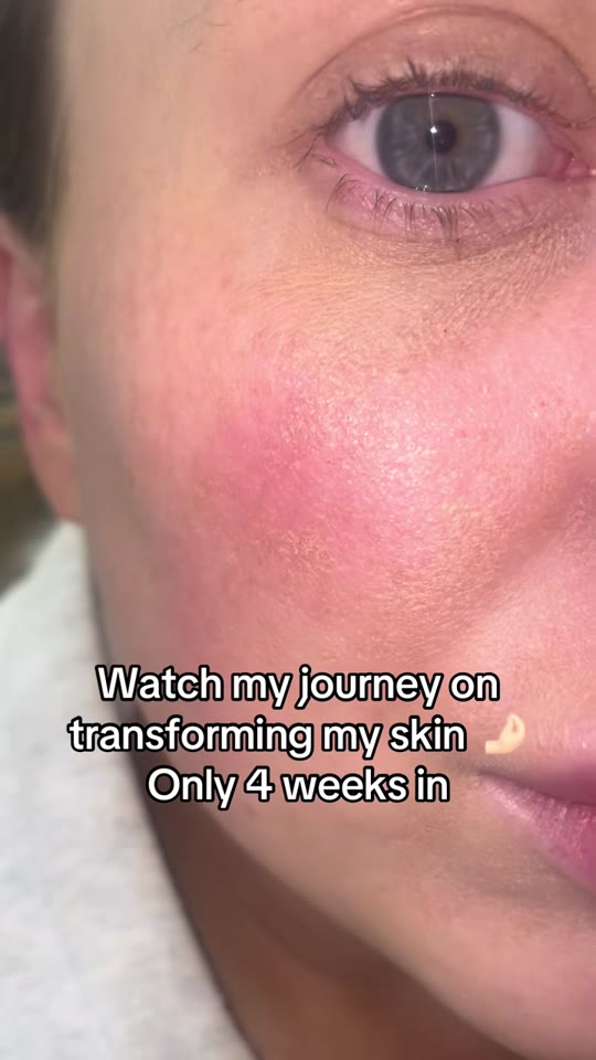GHK-Cu copper peptides for skin: what the evidence actually shows