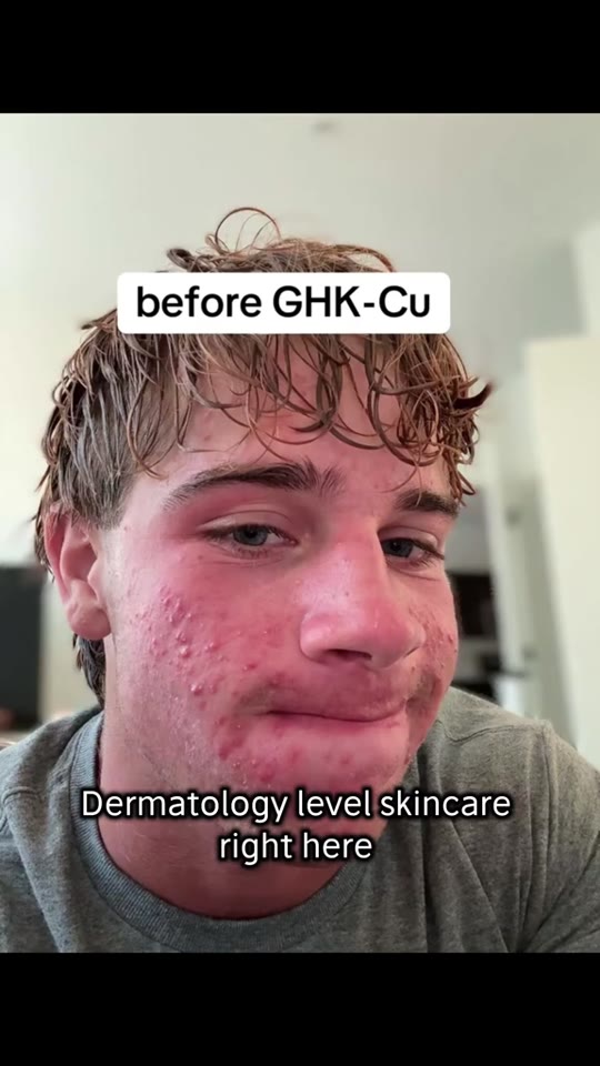 GHK-Cu copper peptides: skin repair claims vs. actual evidence