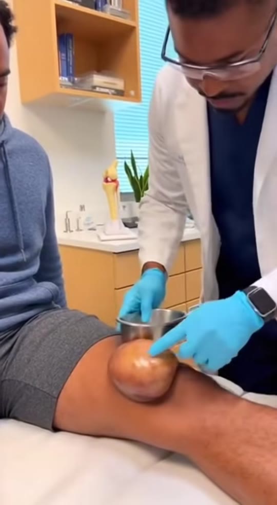 GHK-Cu for acne: what TikTok gets wrong about peptide skin claims