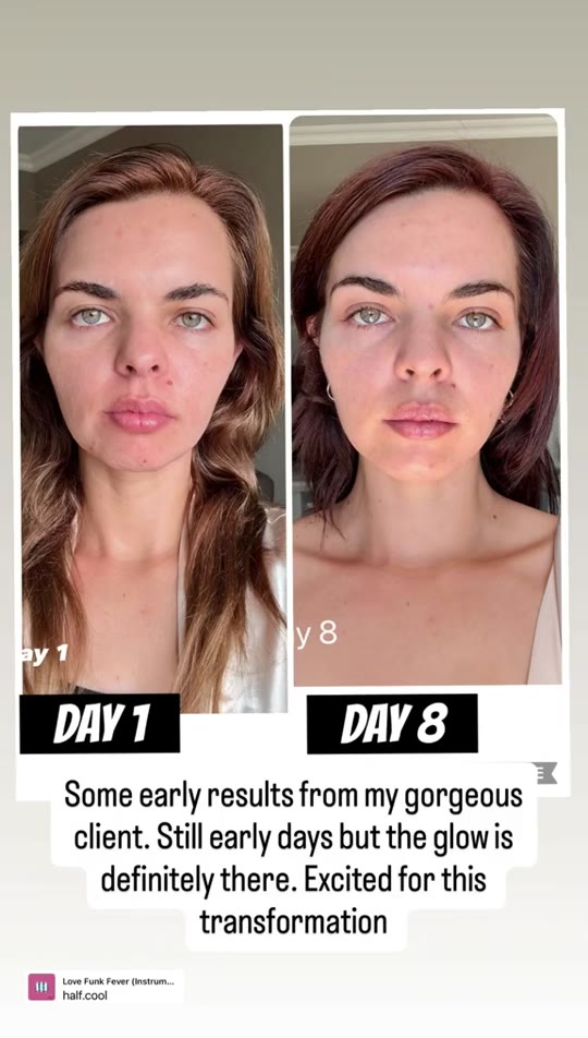 GHK-Cu nasal spray for skin: what the science says