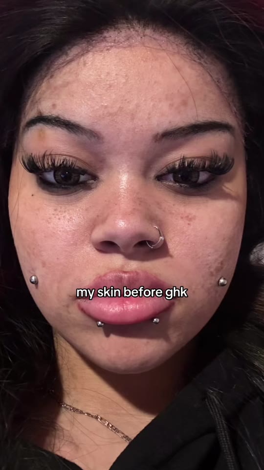 Peptide skincare claims on TikTok: what the science says