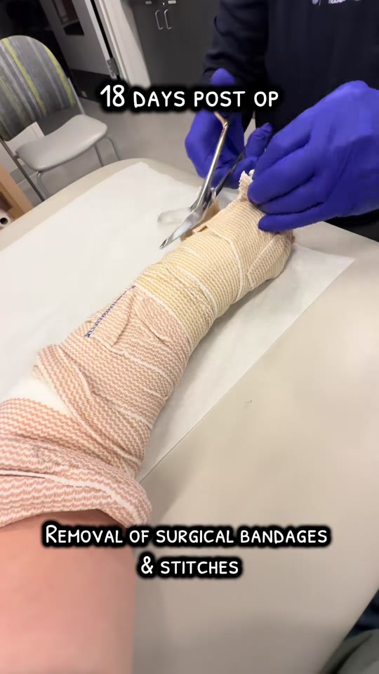 BPC-157 and TFCC repair: what post-op peptide claims get wrong