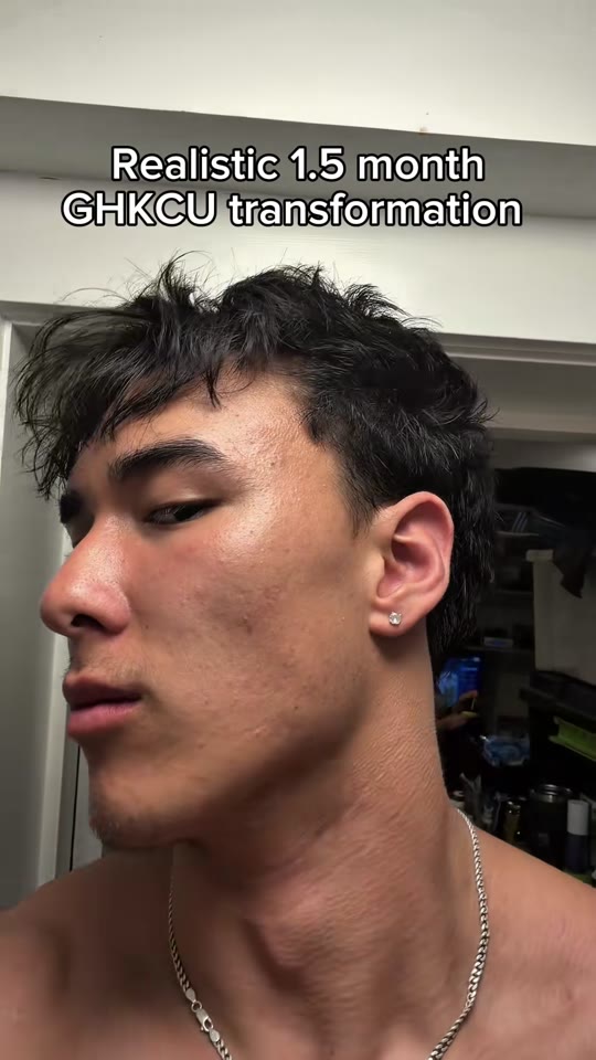GHK-Cu peptide skincare claims on TikTok, fact-checked
