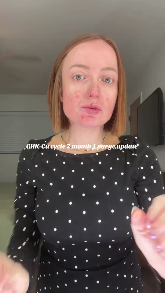 @justsaracherry's GHK-Cu copper uglies claims checked
