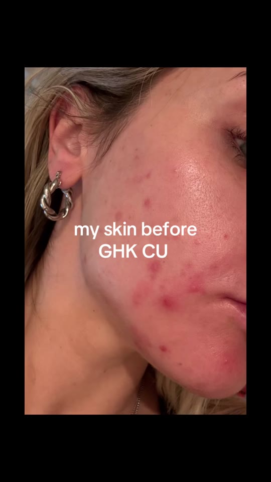 @adwellnesscoaching's GHK-Cu skin claims, fact-checked