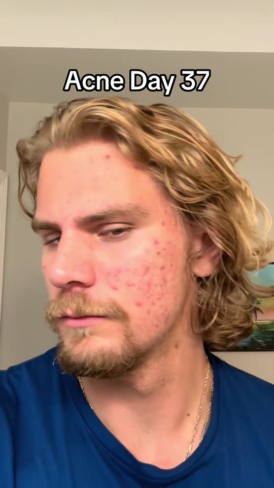 Peptide therapy TikTok claims: separating signal from hype