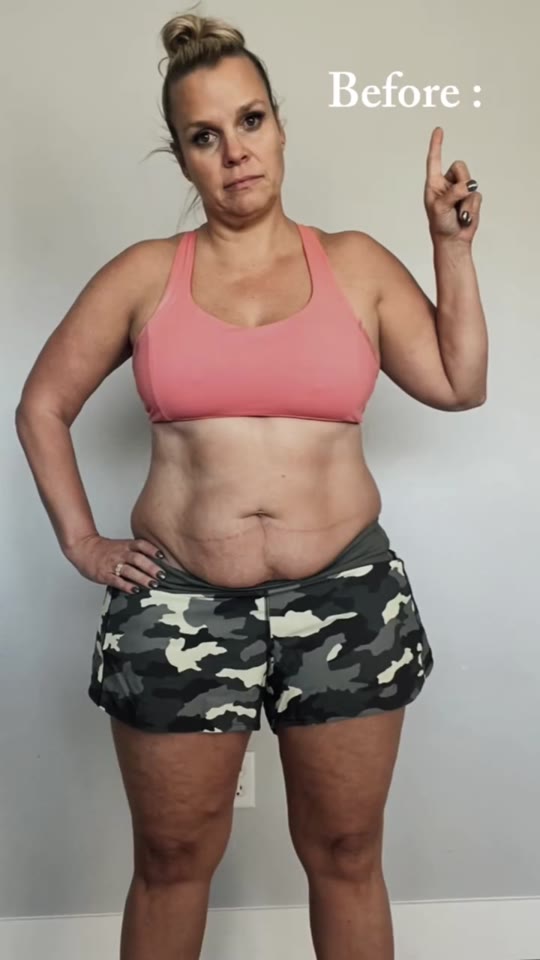 Peptide therapy claims on TikTok: separating hype from evidence