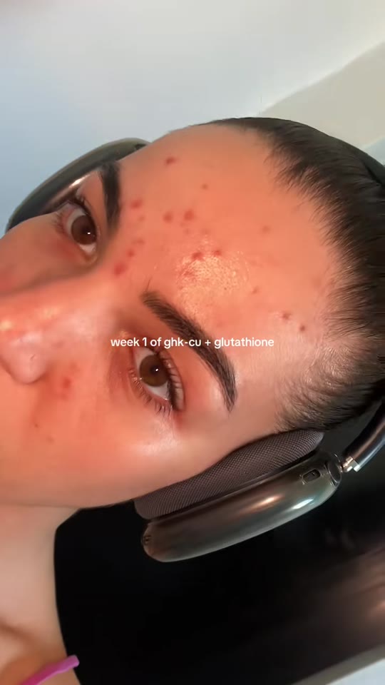 @antidotexashley's peptide therapy claims need context